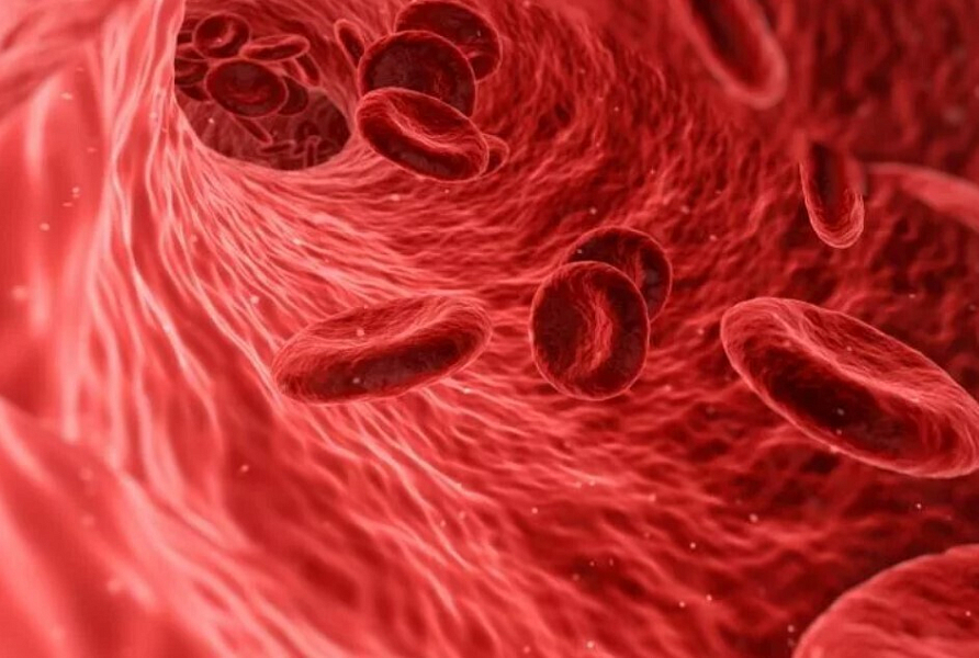 Поражение глаз при тромбофилии